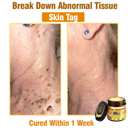 LOVILDS™ Bee Venom All-in-One Cream 👩‍⚕️US Dermatologist Approved