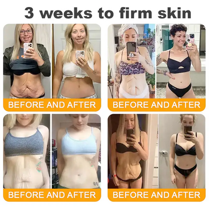 LOVILDS™  Bee Poison Skin Restoration Cream 👨‍⚕️（🔥LAST DAY SALE-80% OFF)🥇👩‍⚕️
