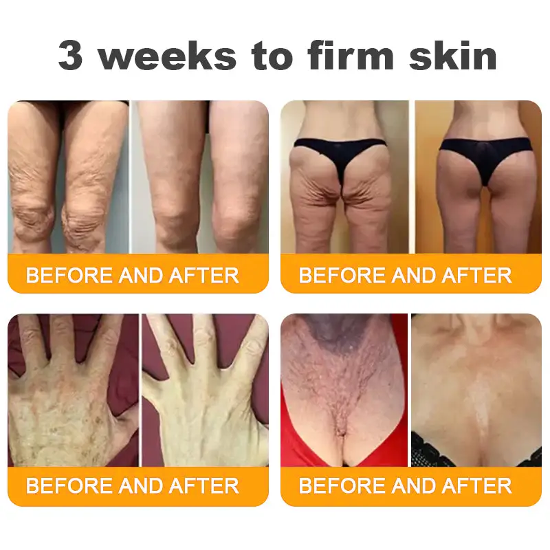 LOVILDS™  Bee Poison Skin Restoration Cream 👨‍⚕️（🔥LAST DAY SALE-80% OFF)🥇👩‍⚕️