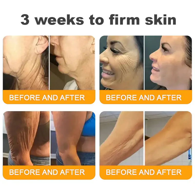 LOVILDS™  Bee Poison Skin Restoration Cream 👨‍⚕️（🔥LAST DAY SALE-80% OFF)🥇👩‍⚕️