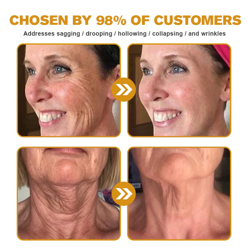 LOVILDS™  Bee Poison Skin Restoration Cream 👨‍⚕️（🔥LAST DAY SALE-80% OFF)🥇👩‍⚕️