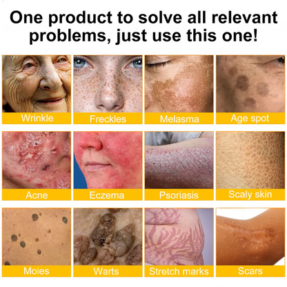 LOVILDS™  Bee Poison Skin Restoration Cream 👨‍⚕️（🔥LAST DAY SALE-80% OFF)🥇👩‍⚕️