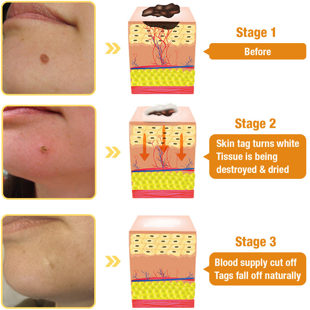 🐝LOVILDS™ TagRecede Bee  Poison Treatment Spray