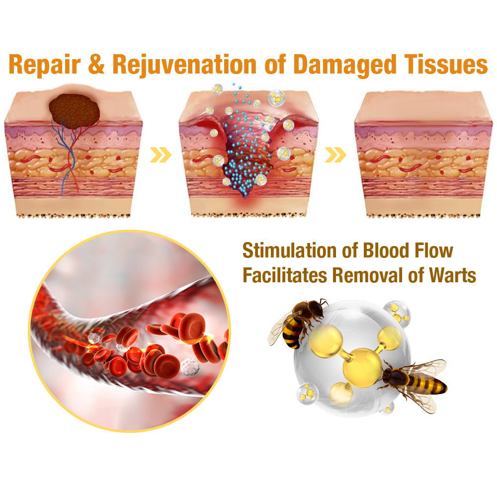 🐝LOVILDS™ TagRecede Bee  Poison Treatment Spray