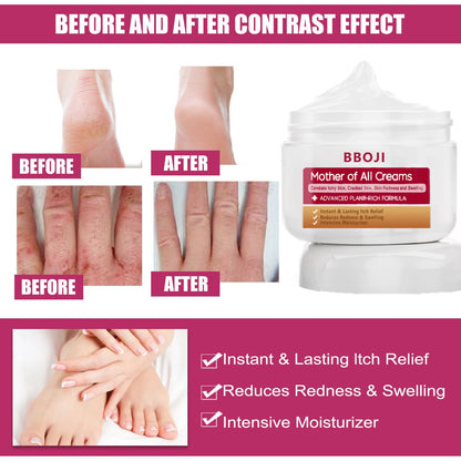 BBOJI™ Multi- Symptom Psoriasis Treatment Cream