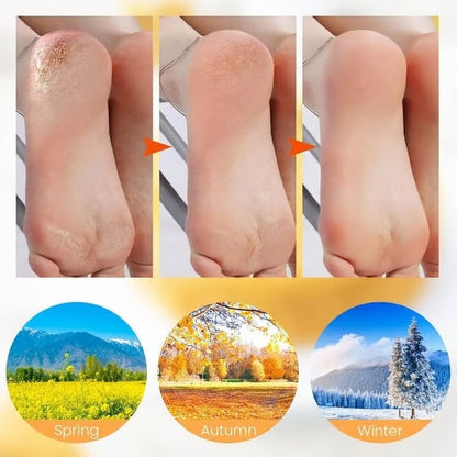 (🔥LAST DAY 80% OFF)🎁Moisturizing Socks
