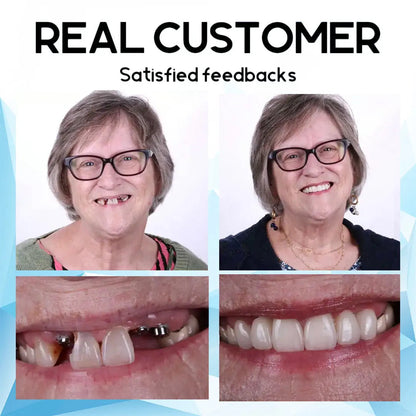 QIAWI™- Premium Custom Silicone Denture Set(🔥Limited time discount Last 30 minutes)