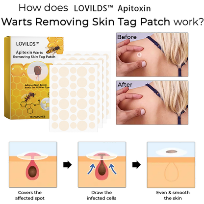 LOVILDS™ Apitoxin Warts Removing Skin Tag Patch