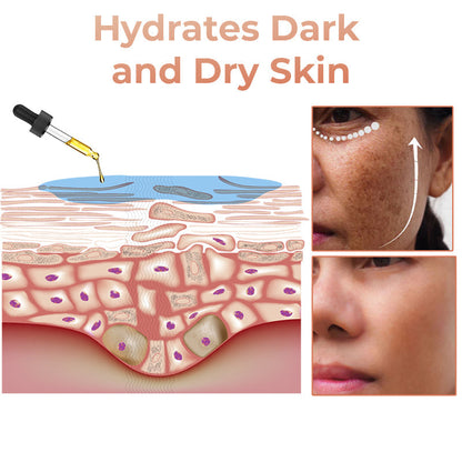 ✨Fast Dark Spot Remover-AQA™  Melanin Correcting Facial Serum(🔥Last Day Promotion 60% OFF)