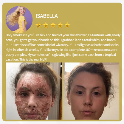 LOVILDS™ Bee Poison Multi care cream  (👨‍⚕️AAD Recommended)